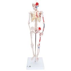 Img